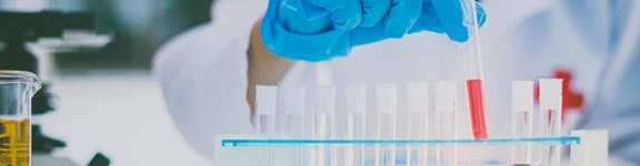Ein Bild von einer Person im Kittel und blauen Gummihandschuhen in einem Labor, die ein Reagenzglas mit rote flüßigkeit anhebt